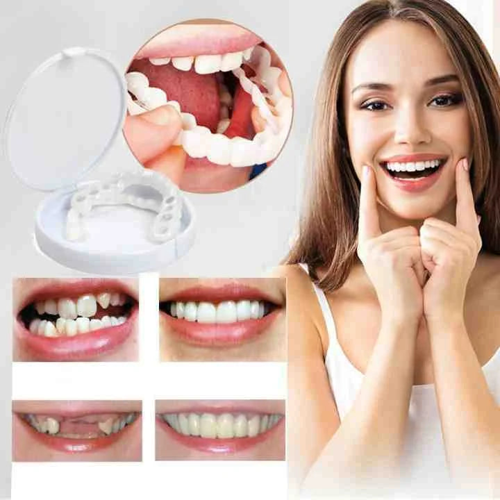 Snap-On Cosmetic Dental Veneers for Adults — Instant Smile Enhancement Solution for Everyday Confidence | Koossa