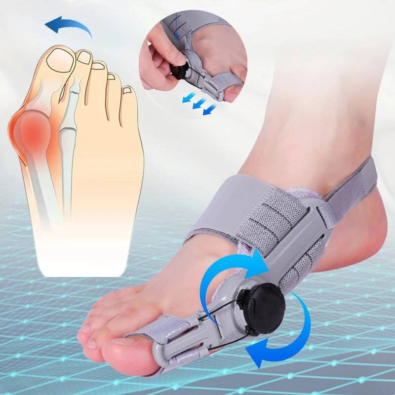 Adjustable Bunion Toe Straightener with Hinge Dial, Soft Silicone Big Toe Spacer for Foot Alignment, Day & Night Use, Universal Fit | Lonoma