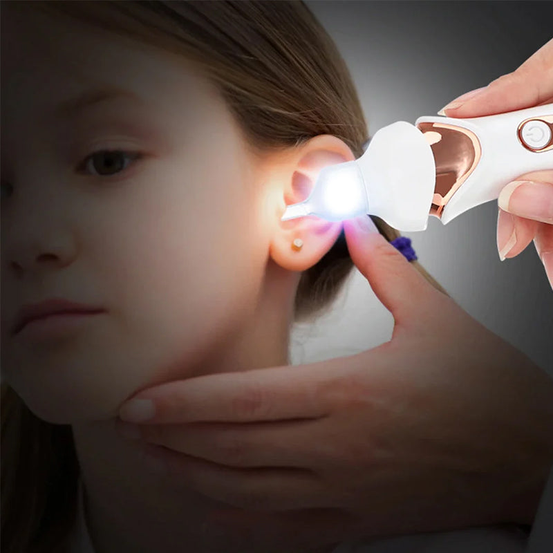 5-in-1 Electric Ear Cleaning Kit with Soft Silicone Tips — Gentle Ear Care Device for Adults & Children | Koossa