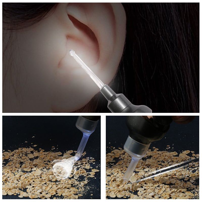 5-in-1 Electric Ear Cleaning Kit with Soft Silicone Tips — Gentle Ear Care Device for Adults & Children | Koossa