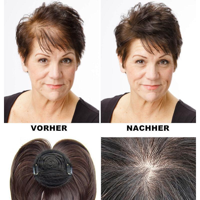 Human Hair Crown Topper Clip-In Hairpiece for Women, Thinning Crown Coverage, Natural Color Hair Toppers for Hair Loss and Volume | Lonoma