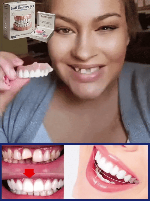 Moldable Cosmetic Denture Set Upper & Lower, Natural White Temporary Teeth, Heat-Fit Smile Cover for Photos and Events | Lonoma