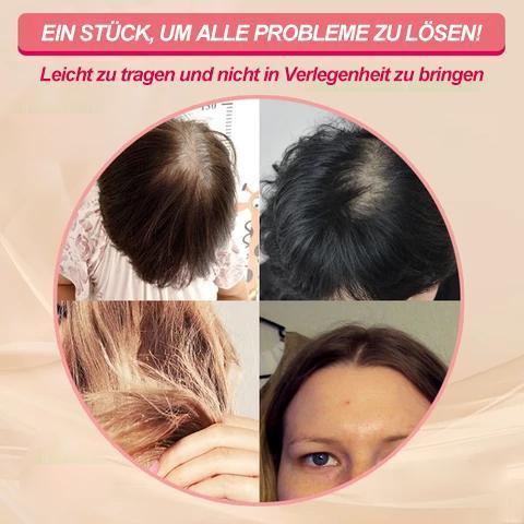 Human Hair Crown Topper Clip-In Hairpiece for Women, Thinning Crown Coverage, Natural Color Hair Toppers for Hair Loss and Volume | Lonoma