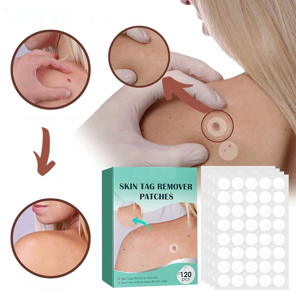 Hydrocolloid Skin Tag Patches 120-Count, Invisible Spot Patches with Tea Tree Oil for Face, Neck & Body, Gentle At-Home Skin Care | Lonoma