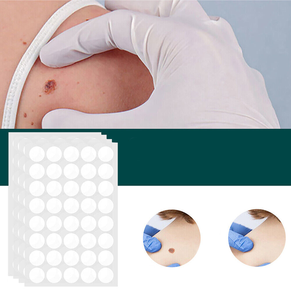 Hydrocolloid Skin Tag Patches 120-Count, Invisible Spot Patches with Tea Tree Oil for Face, Neck & Body, Gentle At-Home Skin Care | Lonoma