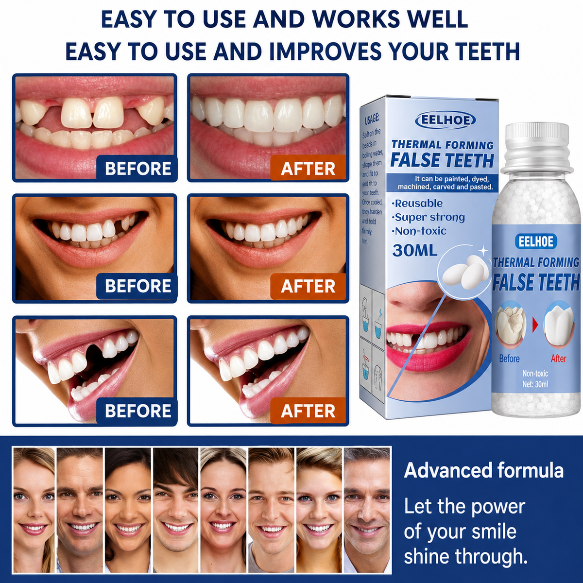 Temporary Tooth Repair Kit for Chipped and Missing Teeth, Moldable Resin Filler, Natural White Cosmetic Dental Fix for Adults & Seniors | Lonoma