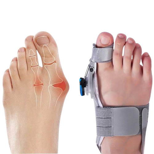 Adjustable Bunion Toe Straightener with Hinge Dial, Soft Silicone Big Toe Spacer for Foot Alignment, Day & Night Use, Universal Fit | Lonoma