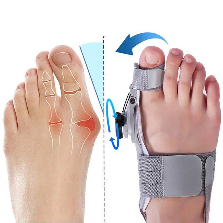 Adjustable Bunion Toe Straightener with Hinge Dial, Soft Silicone Big Toe Spacer for Foot Alignment, Day & Night Use, Universal Fit | Lonoma